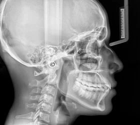 3_Ana Luiza_Teste_fastTelerradiografia_05-01-2023_025132_1